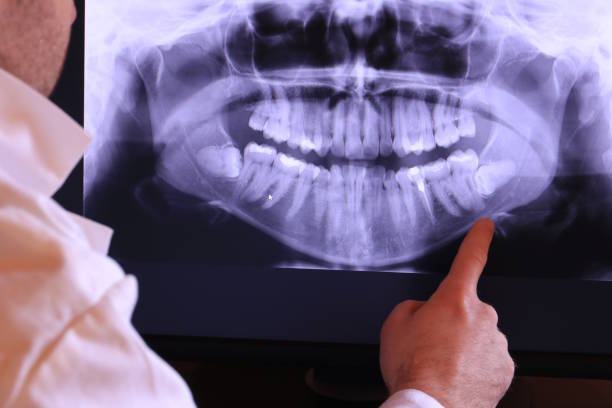 Best Emergency Gum Treatment in Short Pump, VA