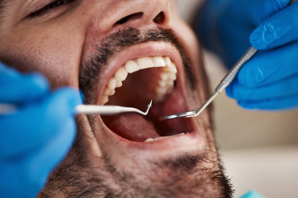 Best Cosmetic Emergency Dentistry in Short Pump, VA