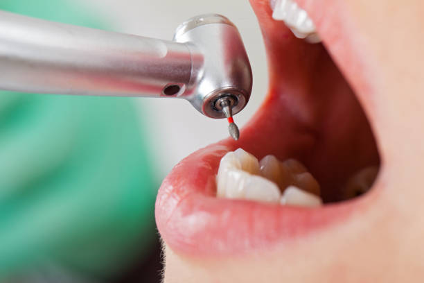 Best Emergency TMJ Treatment in Short Pump, VA